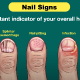 Natural healthy fingernails resting on light surface